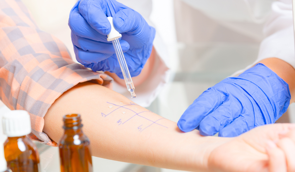 Der Prick-Test als Diagnose-Methode Der Prick-Test als Diagnose-Methode